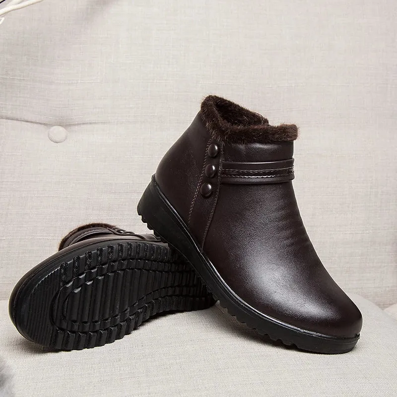 Cuzcare Orthopedic Snow Boots Women Leather Ankle Shoes